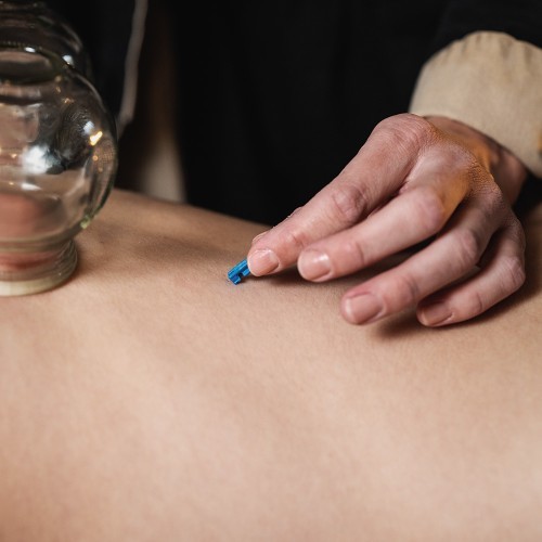 Cupping Therapy Set inSPORTline Sebsahar