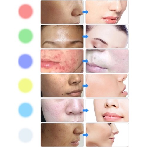 LED Light Therapy Facial Machine inSPORTline Coladome 600