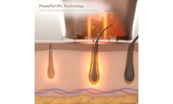 IPL epiliatorius inSPORTline Eriva