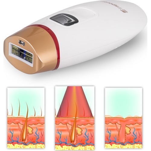 IPL Epilator inSPORTline Eriva